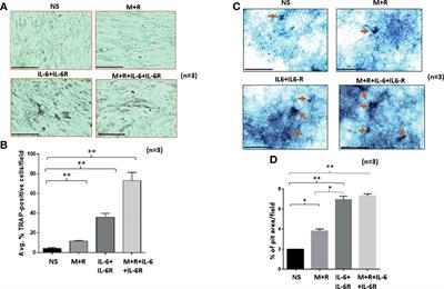 Ets-2 Propagates IL-6 Trans-Signaling Mediated Osteoclast-Like Changes in Human Rheumatoid Arthritis Synovial Fibroblast